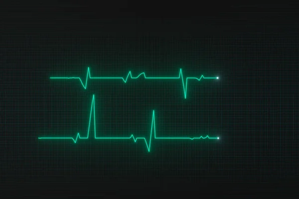 Glowing digital heartbeat line reflecting on the monitor, 3d rendering. — Stock Photo, Image