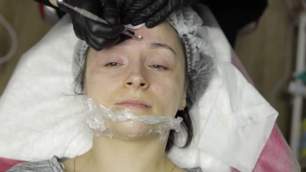 원생 학 자들 이 얼굴을 닦는 여성의 얼굴에 있는 피부 여드름 제거 수술을 한다 — 비디오