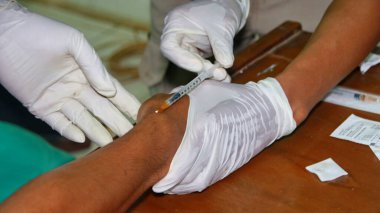 Odaklanamayan, bulanık seçici odak ve gürültü görüntüsü COVID-19 virüs testi, Coronavirus krizi, küresel salgın, hızlı strep testi (RST) kiti, hızlı antijen tespiti (RADT)