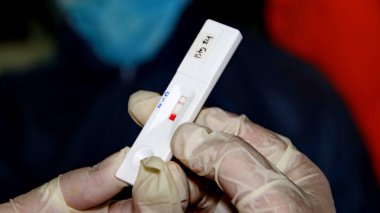 Toplum, Batang, Endonezya, 27 Mayıs 2020 'de hızlı bir test yaparken bulanık seçici odaklanma ve gürültü imajı çalışanları