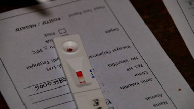 Odaklanamayan, bulanık seçici odak ve gürültü görüntüsü COVID-19 virüs testi, Coronavirus krizi, küresel salgın, hızlı strep testi (RST) kiti, hızlı antijen tespiti (RADT)