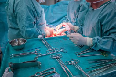 Bir cerrahi ekip cerrahi karın ameliyatı gerçekleştirir.