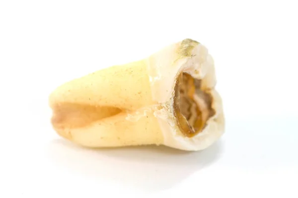 Råttent tann på hvit bakgrunn – stockfoto