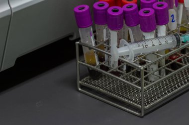 Kan testi laboratuvar donatımı 