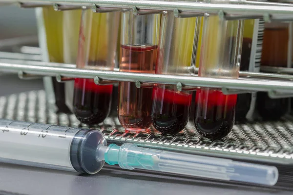 Kan testi laboratuvar donatımı 