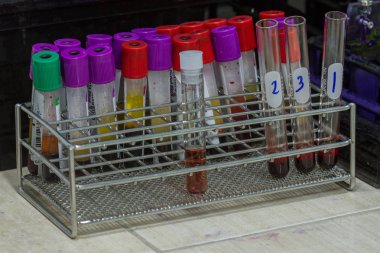 balgam genexpert test Mycobacterium tüberküloz için