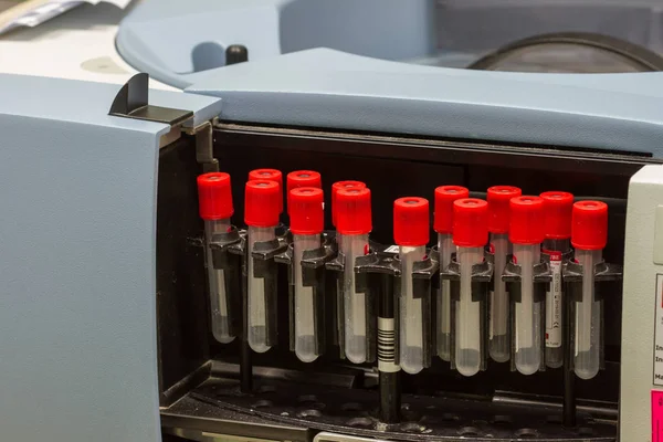 tıbbi kan ayırma testi santrifüj