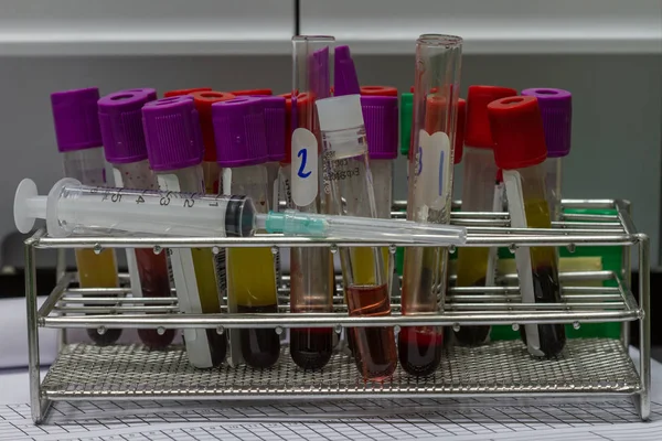 Equipamento médico exame de sangue em laboratório — Fotografia de Stock