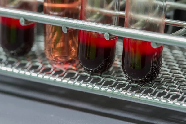 Kan testi laboratuvar donatımı 