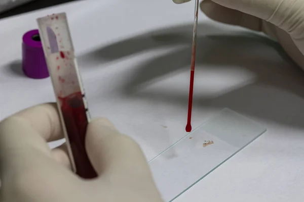 医者は滅菌のスライドに血を一滴を置く — ストック写真