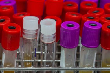 Kan testi laboratuvar donatımı