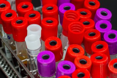 Kan testi laboratuvar donatımı