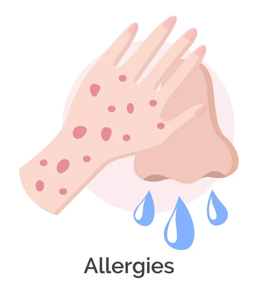 Sintomi di allergie, eruzione cutanea sulle mani e naso che cola — Vettoriale Stock