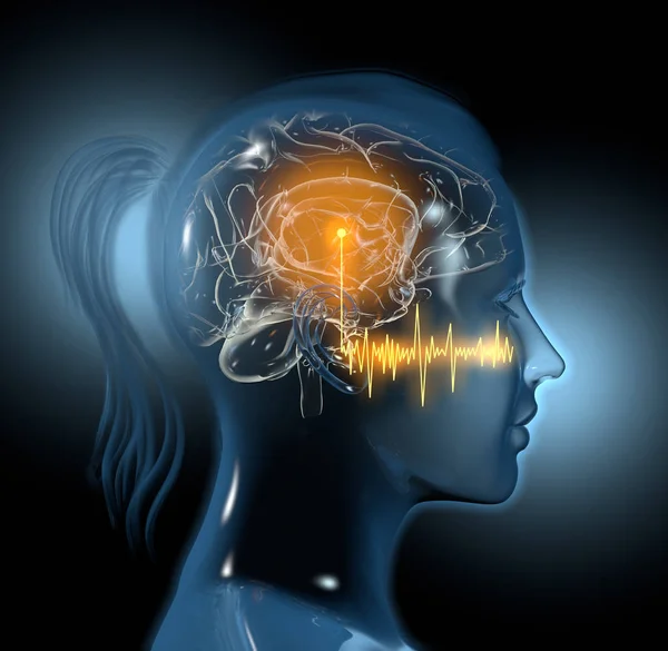 Tinnitus, akut hörselnedsättning, ljudvågor, medicinskt 3d illustra — Stockfoto