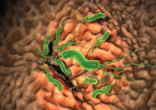 Гастрит, бактерии helicobacter pylori повреждающие слизистый слой, я — стоковое фото