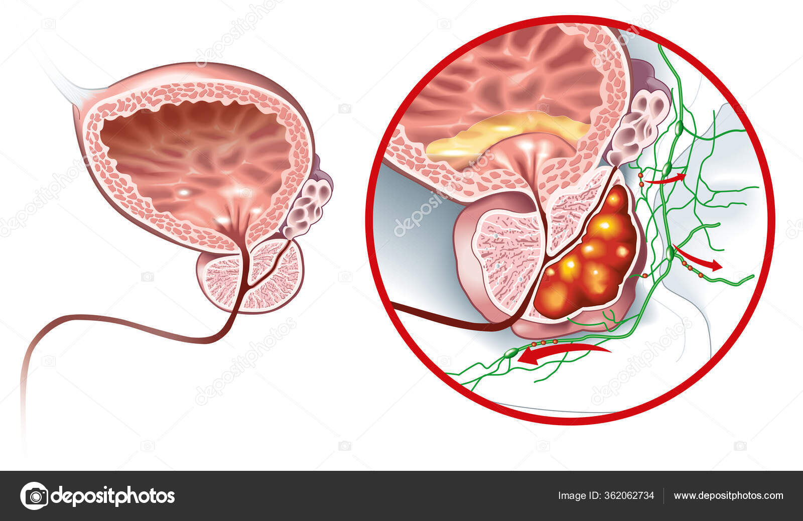 depositphotos_362062734-stock-illustration-medically-illustration-showing-healthy-prostate.jpg