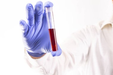 Genç bir doktor, tıbbi maske ve eldivenli bir laboratuvar çalışanı, beyaz arka planda üzerinde kan örneği olan bir tüp tutuyor. Periyodik kan testi. Coronavirus testi. Bir korona salgını.