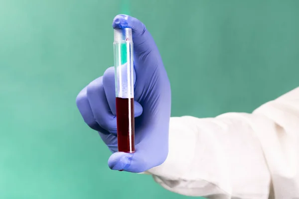 医療用手袋の手 血液サンプルと試験管を保持 緑の背景に クローズアップ 定期的な血液検査 コロナウイルス検査 コロナ大流行 — ストック写真