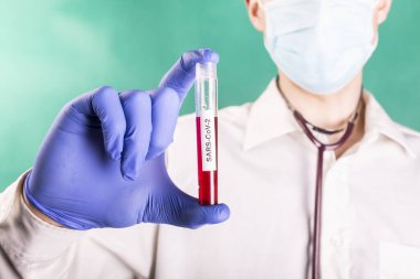 Cerrahi maskeli genç bir doktor elinde kan örneğiyle bir test tüpü tutuyor. Corona. Coronavirus testi.