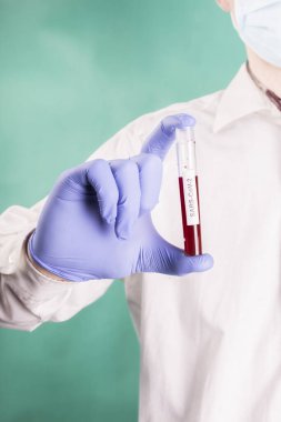 Cerrahi maskeli genç bir doktor elinde kan örneğiyle bir test tüpü tutuyor. Corona. Coronavirus testi.