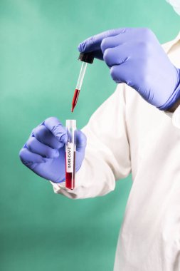 Ameliyat maskesi ve eldiveni olan genç bir laboratuvar çalışanı elinde test tüpü tutuyor ve yeşil arka planda pipetli kan örneği alıyor. Coronavirus testi. Bir korona salgını SARS-CoV-2