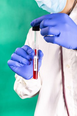 Cerrahi maskeli doktor deney tüpü tutuyor ve pipetle kan örneği alıyor. Corona patojeni. Coronavirus testi.