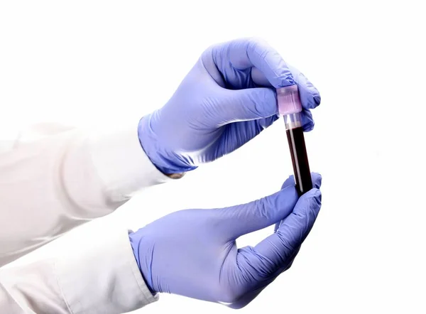 若い医師 実験室の開業医は 白い背景に血液サンプルを用いた試験管を保持しています コロナウイルスのパンデミック コロナウイルス — ストック写真