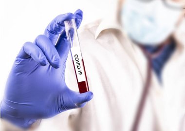 Eldiven giymiş bir doktorun eli, tıbbi yüz maskeli bir laboratuvar çalışanı, üzerinde COVID-19 adlı kan örneğiyle bir tüp tutuyor. Kan testi. Coronavirus testi. Bir korona salgını.