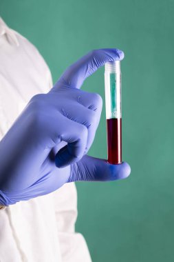 Tıbbi eldivenli bir el, üzerinde kan örneği olan bir tüp tutuyor, yeşil bir arka planda, yakın plan. Periyodik kan testi. Coronavirus testi. Bir korona salgını.