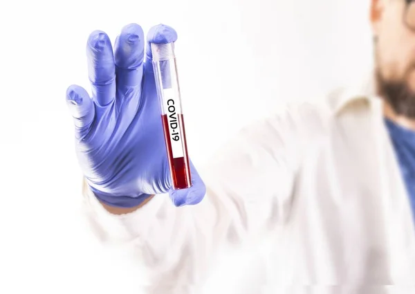 手袋の医師の手 血液サンプルと試験管を保持している実験室の開業医 Covid 19という名前 血液検査 コロナウイルス検査 コロナ大流行 — ストック写真