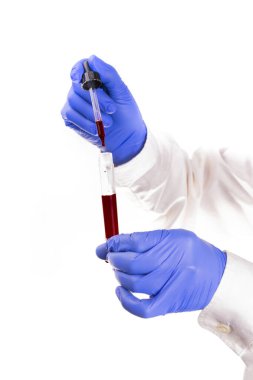 Bir tıp çalışanının ellerinin koruyucu eldivenlerle dikey görüntüsü, bir test tüpü tutarken ve bir pipetle kan örneği alırken, beyaz bir arka planda, kopyalanmış. Coronavirus testi. Bir taç. .