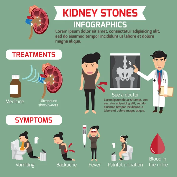 Traitement et symptômes de l'infographie rénale. vecteur illustrati — Image vectorielle