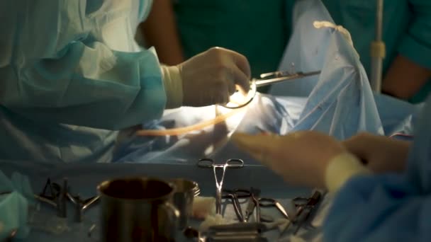 De operatie aan een persoon wordt uitgevoerd door een ervaren chirurg — Stockvideo