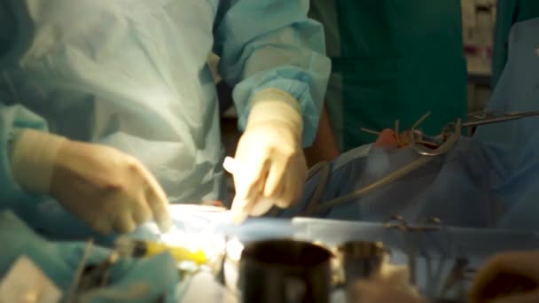 The operation on a person is carried out by an experienced surgeon — Stock Video