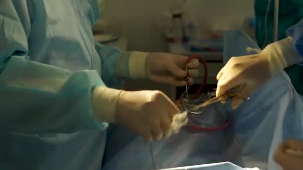 Операцию на человеке проводит опытный хирург — стоковое видео