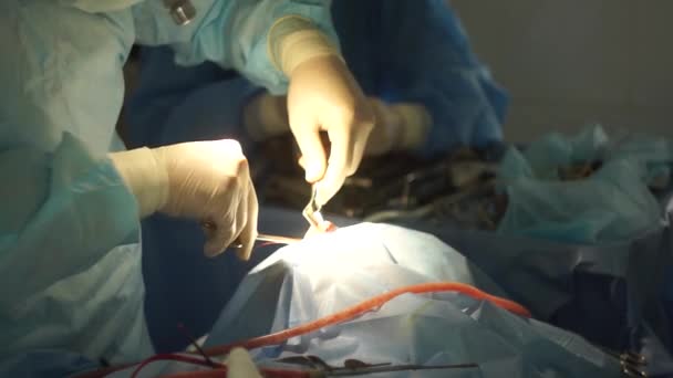 The operation on a person is carried out by an experienced surgeon — Stock Video