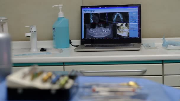 Οδοντίατρος Αντιμετωπίζει Και Λευκαίνει Δόντια Έναν Ασθενή Στην Κλινική — Αρχείο Βίντεο