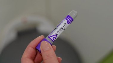 Virüslü test tüpü atıldı