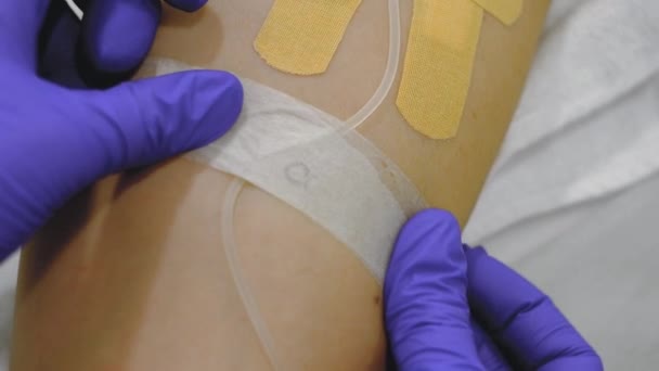 Terapia per infusione endovenosa contro il coronavirus — Video Stock