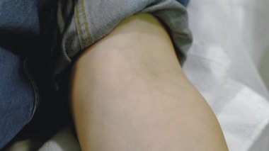 applying a tourniquet and treating the injection field