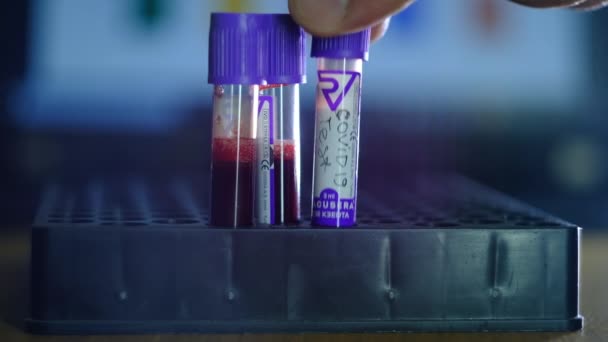 Tubos de análisis de sangre para el análisis del virus coronavirus — Vídeos de Stock