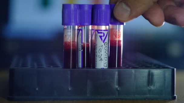 Medical test tubes with blood of patients — Stock Video