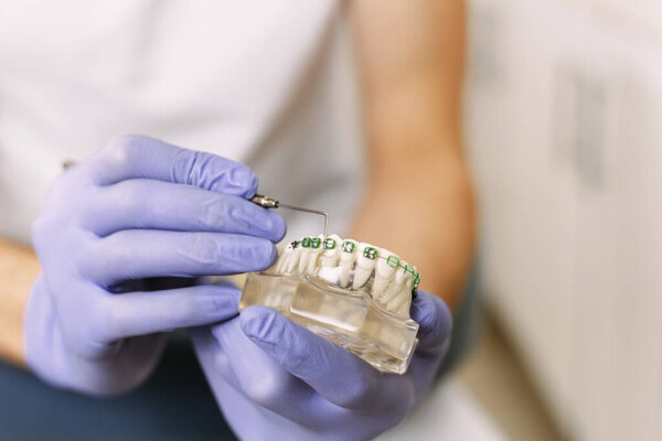 The dentist shows an artificial model of the jaw with braces and points to it with a dental tool. dentist in purple rubber gloves shows new dental braces for patients.