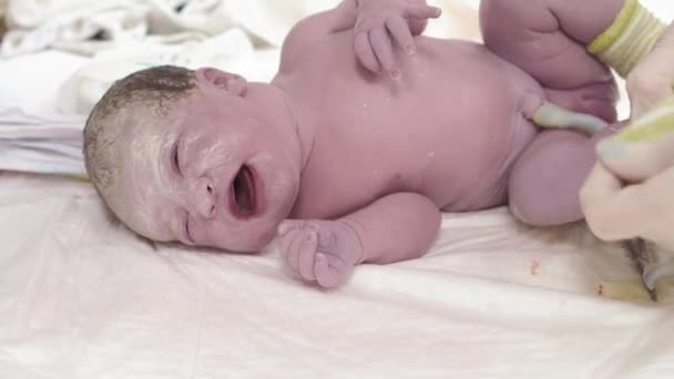 Младенец после рождения плачет первые минуты жизни. Женские руки лечат пупок плачущего новорожденного в первые минуты после родов . — стоковое видео