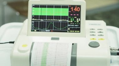 EKG monitörü kardiyograf. Rahimdeki bebeğin kalp atışlarının ölçümü sırasında kardiyograf görüntüsü. Doğumdan önce bebeğin kalp atışlarının kardiyografla ölçülmesi.