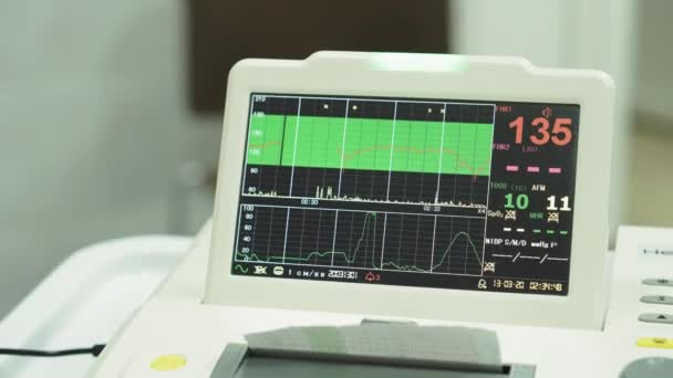 EKG monitor Cardiógrafo. Visualización del cardiógrafo durante la medición de los latidos cardíacos del bebé en el útero. Medición de los latidos cardíacos del bebé en el útero mediante un cardiógrafo antes del nacimiento . — Vídeos de Stock