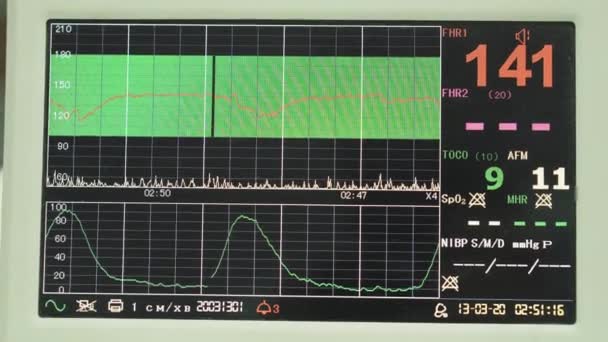 Monitoraggio ECG Cardiografo. Display cardiografico durante la misurazione del battito cardiaco dei bambini nell'utero . — Video Stock