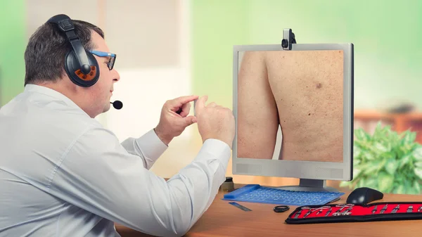 Telemedicine dermatologist looking sebaceous cyst on monitor — Stock Photo, Image