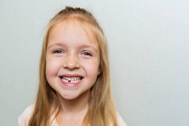 İlk süt dişini gösteren çocuk. Diş konseptini değiştir. Gri arkaplanda sarı saçlı ve fotokopi alanı olan tatlı küçük kız.