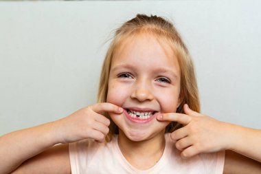 İlk süt dişini gösteren çocuk. Diş konseptini değiştir. Gri arkaplanda sarı saçlı ve fotokopi alanı olan tatlı küçük kız.